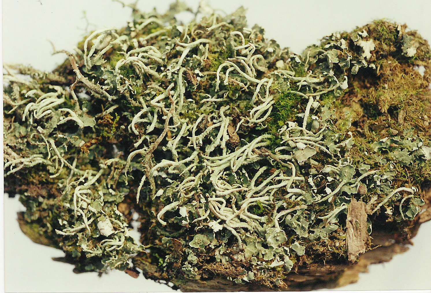 foliose lichen under microscope