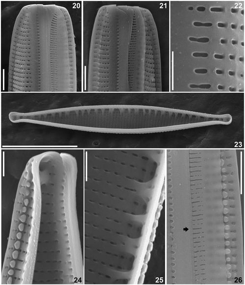 Two new species of Nitzschia (Bacillariophyta) from shallow wetlands of ...