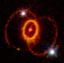 The multiple rings around SN1987A.