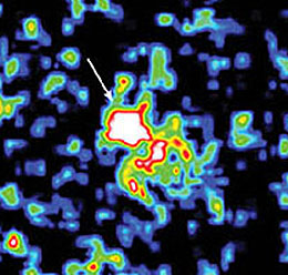 A GRB event in the Milky Way, imaged at X-ray wavelength by Beppo-SAX.